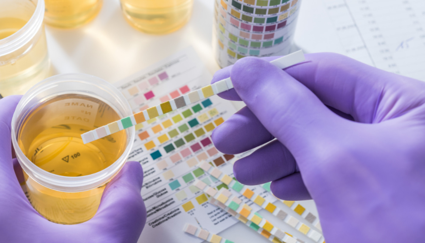Diététique - Contrôler la qualité de son urine avec des bandelettes de test : un geste simple pour un bien-être optimal